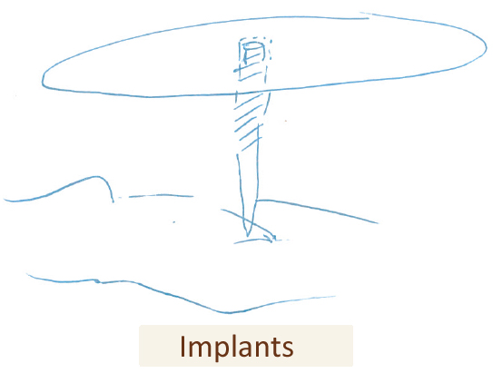 Implants